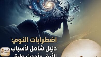 اضطرابات النوم